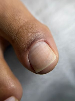 Russian Pedicure Foundation